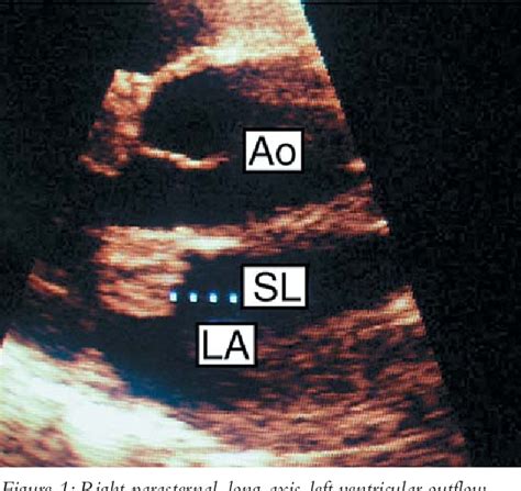 Figure From Schl Sselw Rter Endocarditis Hund Enterococcus