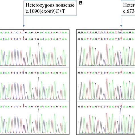 Sanger Sequencing Chromatograms Of The Gnptab Gene Variants In This