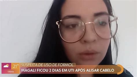 Pol Cia Investiga Caso De Mulher Que Ficou Na Uti Ap S Escova