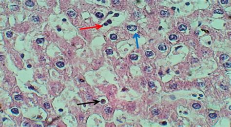 4.6) : Section of liver in T2 group that treated with Acetaminophen and ...