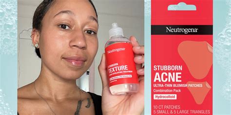 I Tested the New Neutrogena Acne Patches and Exfoliating Treatment | SELF