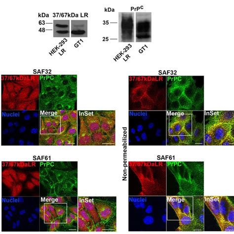 Expression Levels And Localization Of Kda Lr And Prp C In Gt And