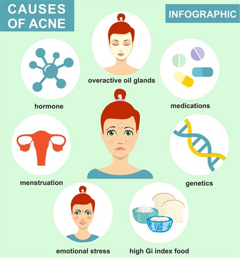 Is The Acne Face Map Legit? Important Facts You Need To Know