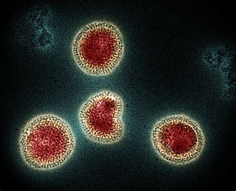 Influenza B Virus Influenza B Virus Particles Colorized R Flickr