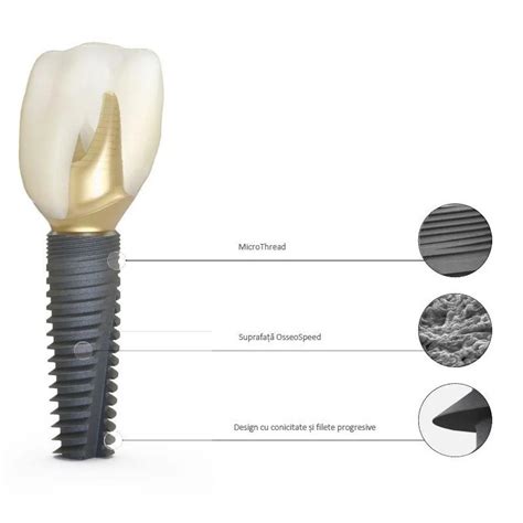 Implant Ds Primetaper Ev D Dentsply Sirona Varianta L Dentstore