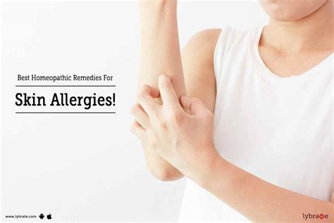 Best Homeopathic Remedies For Skin Allergies By Dr Chetan Raj Lybrate