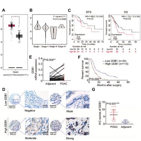 Ddb Is Required For Cell Proliferation And Emt In Pdac A Western