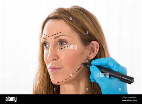 Plastic Surgery Lines Mature Hi Res Stock Photography And Images Alamy