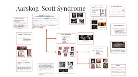 Aarskog-Scott Syndrome by Lori Snyder on Prezi