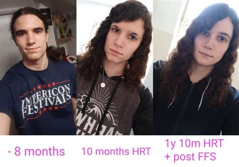 From 20 Years Old To 23 Years Old And Almost 2 Years Hrt As Well As Ffs Rtranstimelines