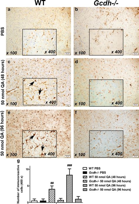 Light Microscopy Images Showing Gfap Immunohistochemistry Staining In