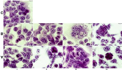 Morphological Changes In Hela Cells Treated With M Emodin For H