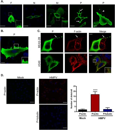 HMPV P induces formation of membrane extensions and co-localizes with ...