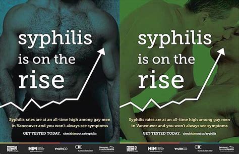 Year High B C Health Officials Warn About Major Spike In Syphilis Among Gay Men The Province