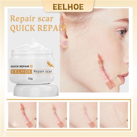 EELHOE Scar Removal Cream Scar Remover Old Scar Acne Scar Removal For