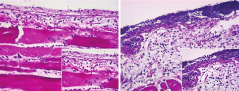 Light Micrographs Of Hematoxylin And Eosin Stained Capsule Tissue At 24