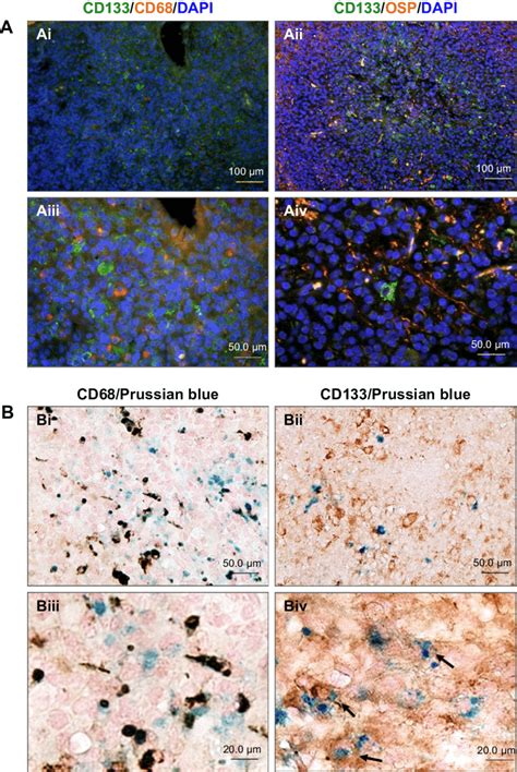 Uspio Cd133 Ab Specifically Targeted To Enu Induced Rat Brain Tumor