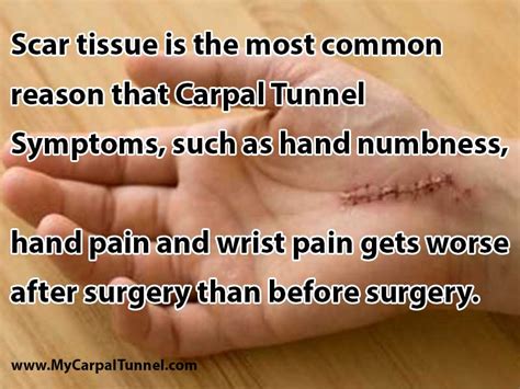 Does Carpal Tunnel Surgery Cause Scar Tissue The Carpal Solution