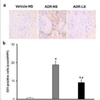 Immunohistochemical staining for osteopontin OPN α smooth muscle