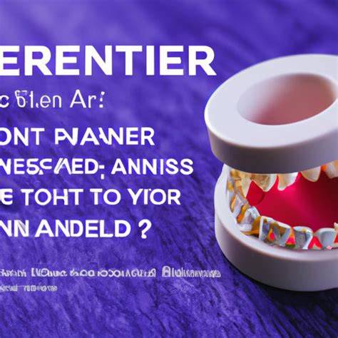 How Much Does a New Retainer Cost? A Comprehensive Guide - The ...