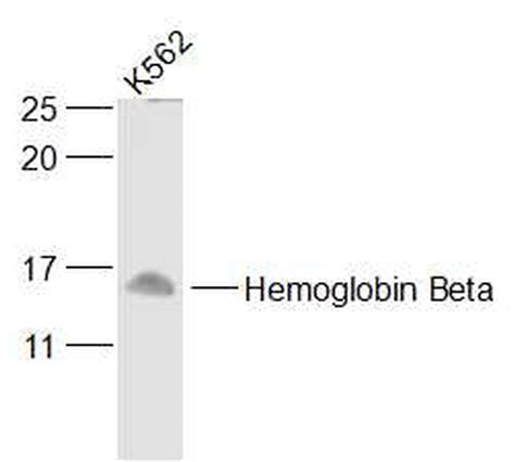 Hbb Hbd Polyclonal Antibody Bs 8554r