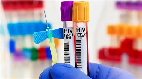 Understanding Variants Exploring Different Types Of HIV AIDS Exist