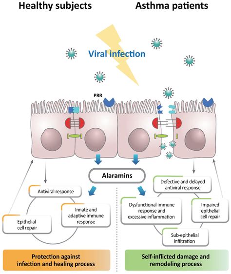 Ijms Free Full Text Viral Infection And Airway Epithelial Immunity In Asthma