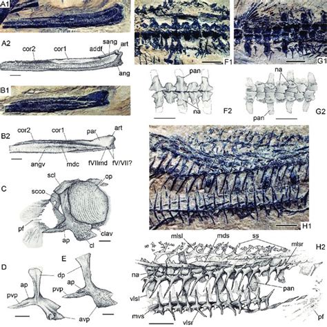 Postcranial Skeleton Of Saurichthys Spinosa Sp Nov A Caudal Region