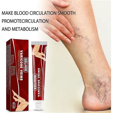 Eelhoe Vein Massage Varicose Cream Relieves Bulging Blood Vessels In