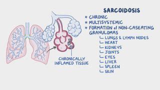 Granulomatosis Infantiseptica: What Is It, Treatment, and More | Osmosis