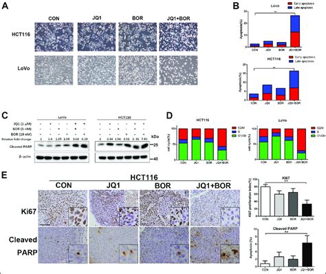 Jq1 And Bortezomib Exhibit Synergistic Cytotoxicity In Beti Resistant