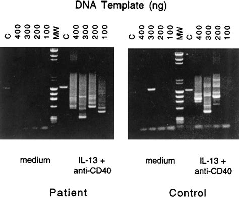 Nested Pcr Amplification Of Switch Fragments Serially Diluted Aliquots