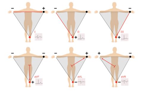 EKG Leads Flashcards | Quizlet