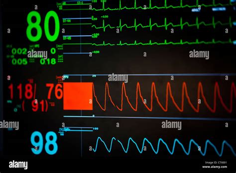 Ecg blood pressure monitoring hi-res stock photography and images - Alamy