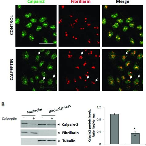 Nucleolar Calpain Levels In Crc Cell Lines With Different Kras