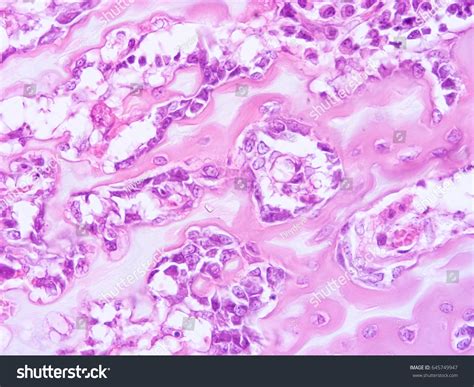 Histology Human Tissue Show Fibrous Cartilage Stock Photo 645749947 ...