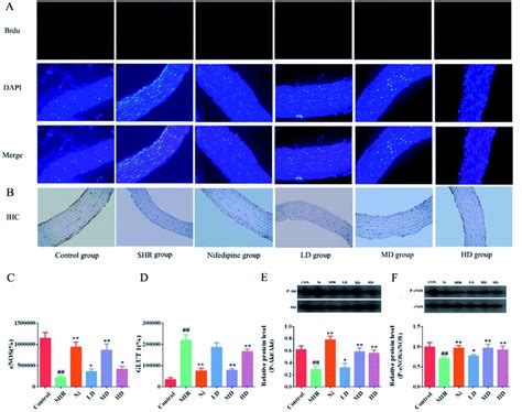 Correction Lc Ms Analysis And Hypotensive Effect Via Inhabiting Glut