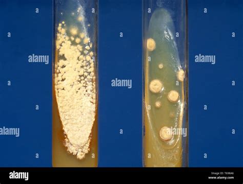 Histoplasma Capsulatum