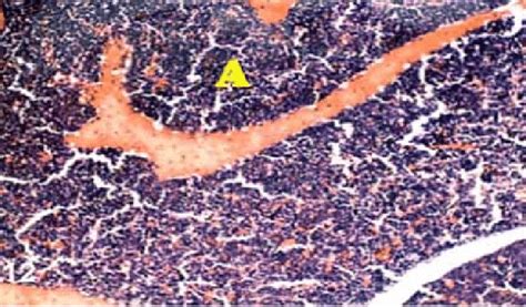 Embryo Spleen A Hyperplasia Of Germination Center And Lymphocytes