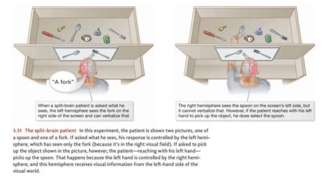 Lateralization