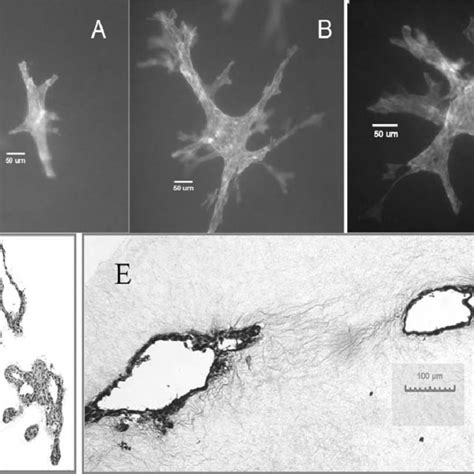 Electron Micrograph Of Bovine Mammary Epithelial Cells In Cultures