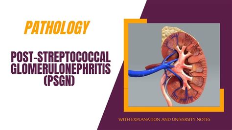 Pathology Post Streptococcal Glomerulonephritis Psgn Renal