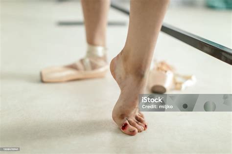 Ballerina And Her Wounded Foot After Training Stock Photo Download