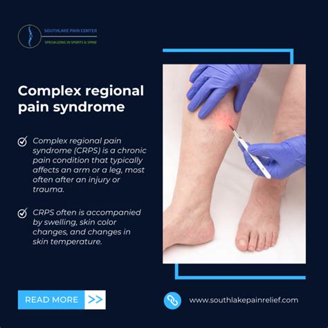 Complex Regional Pain Syndrome Treatment In Southlake Tx South Lake Pain Center Pain