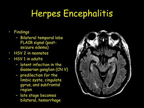 Ppt Anoxic Brain Injury Powerpoint Presentation Free Download Id 9709070