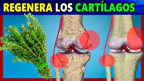 Regenera Los Cartílagos Dañados De Una Forma Rápida y Sencilla