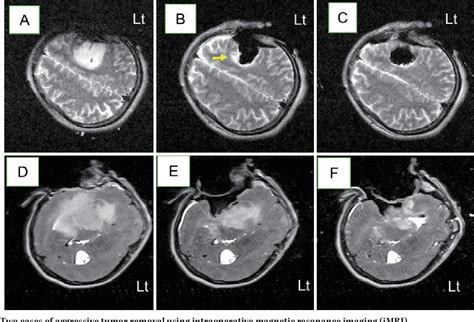 Figure From Information Guided Surgery Centered On Intraoperative