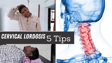 5 Best Loss Of Cervical Lordosis Exercises And Home Tips For Neck Pain