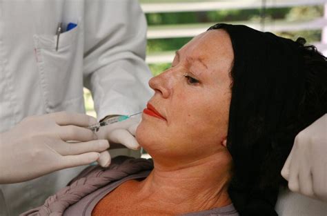 Za Par Stotina Eura Nude Ilegalne Materijale U Hrvatskoj Evo Koliko Su Opasni Estetski Zahvati