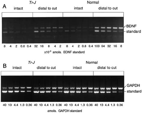 Rt Pcr Of Bdnf And Gapdh Mrnas In Tr J And Normal Sciatic Nerves Rna